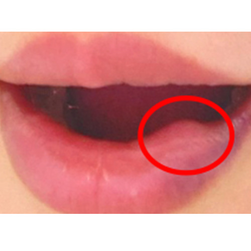 Before Image