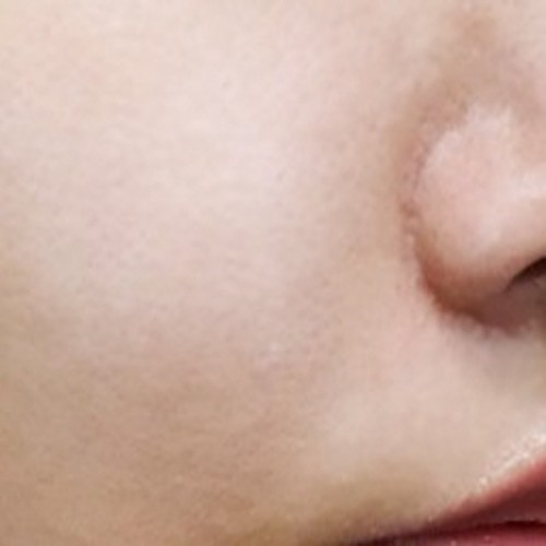 줄기세포 프로그램