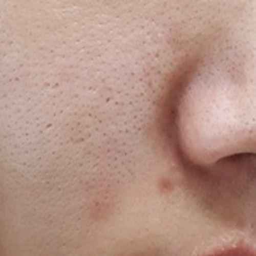 줄기세포 프로그램