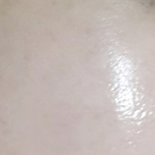 줄기세포 프로그램