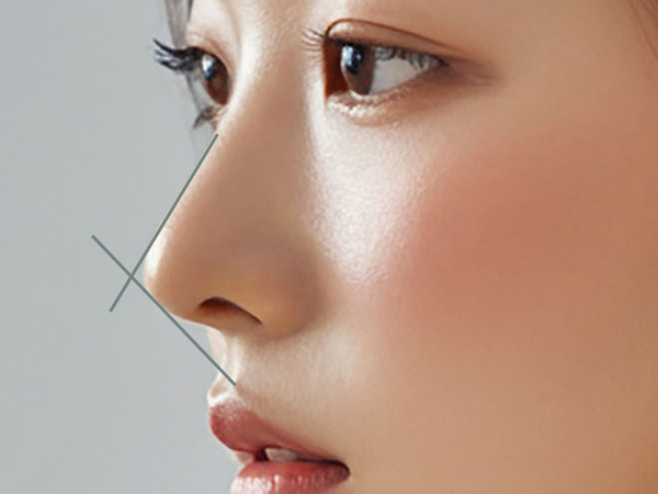 에그볼륨 페이스·바디 필러 페이스 바디 에그 볼륨